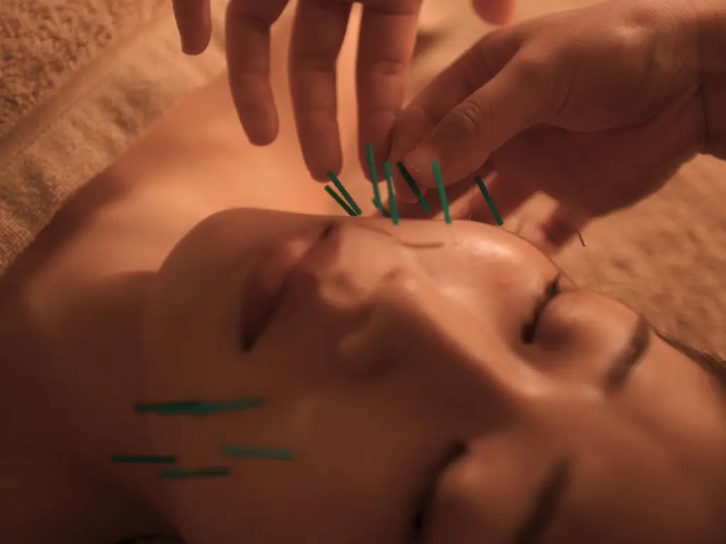 ベーシック美容鍼(微弱電流なし)