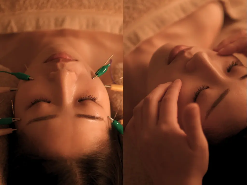 首肩もみほぐし＋炭酸ヘッド＋美容鍼or小顔矯正