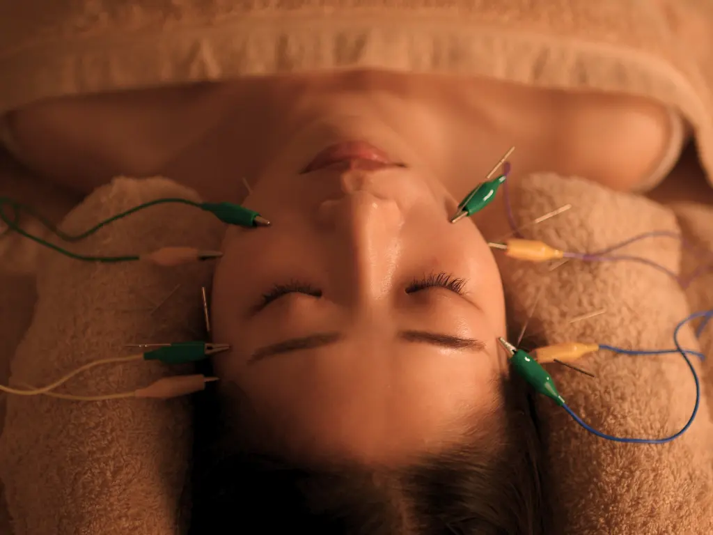 クイックリフト美容鍼(微弱電流あり)